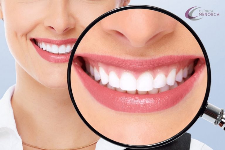 Funcionan Los Trucos Y Remedios De Blanqueamiento Dental Casero